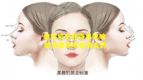 做完填充和隆鼻吃啥 做完隆鼻吃啥消炎药